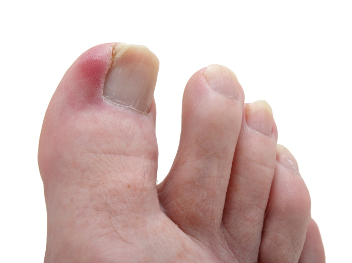 A close up of someone 's foot with red and white spots on them.